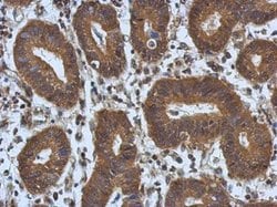 Invitrogen ARC Polyclonal Antibody 100 &mu;L; Unconjugated:Antibodies,