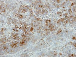 Invitrogen SFRP2 Polyclonal Antibody 100 μL; Unconjugated:Antibodies,