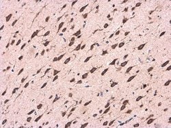 Invitrogen CDK5RAP1 Polyclonal Antibody 100 &mu;L; Unconjugated:Antibodies,