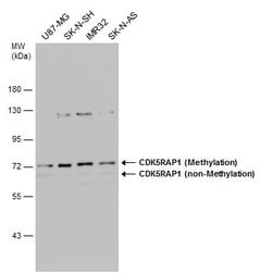 Invitrogen CDK5RAP1 Polyclonal Antibody 100 &mu;L; Unconjugated:Antibodies,