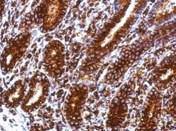 Invitrogen CD74 Polyclonal Antibody 100 &mu;L; Unconjugated:Antibodies,