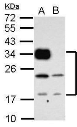 Invitrogen CD74 Polyclonal Antibody 100 &mu;L; Unconjugated:Antibodies,