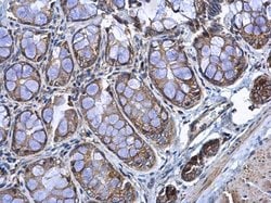 Invitrogen RPL17 Polyclonal Antibody 100 &mu;L; Unconjugated:Antibodies,