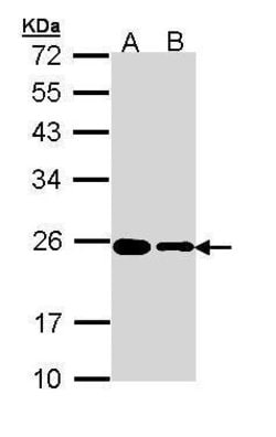 Invitrogen RPL17 Polyclonal Antibody 100 &mu;L; Unconjugated:Antibodies,