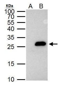 Invitrogen Securin Polyclonal Antibody 100 &mu;L; Unconjugated:Antibodies,