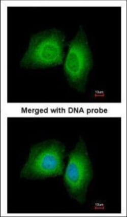 Invitrogen MARK1 Polyclonal Antibody 100 &mu;L; Unconjugated:Anticuerpos