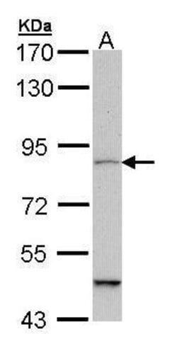 Invitrogen MARK1 Polyclonal Antibody 100 &mu;L; Unconjugated:Antibodies,