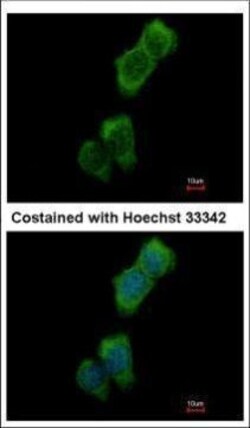 Invitrogen LOK Polyclonal Antibody 100 &mu;L | Buy Online | Invitrogen&trade; | Fisher Scientific