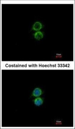 Invitrogen PIP5K1A Polyclonal Antibody 100 &mu;L; Unconjugated:Antibodies,
