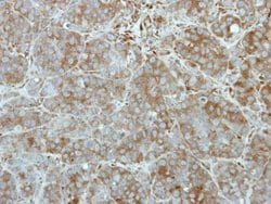 Invitrogen TEX14 Polyclonal Antibody 100 &mu;L | Buy Online | Invitrogen&trade; | Fisher Scientific