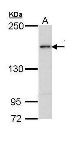 Invitrogen TEX14 Polyclonal Antibody 100 &mu;L | Buy Online | Invitrogen&trade; | Fisher Scientific