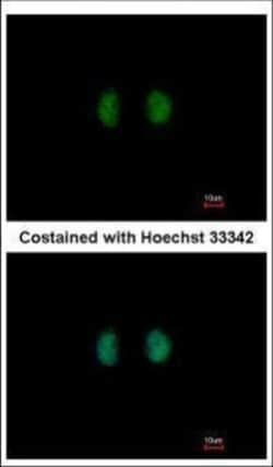 Invitrogen IPPK Polyclonal Antibody 100 &mu;L; Unconjugated:Antibodies,