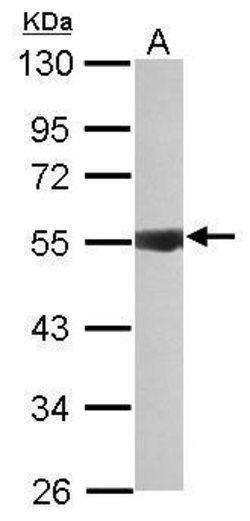 Invitrogen IPPK Polyclonal Antibody 100 &mu;L; Unconjugated:Antibodies,