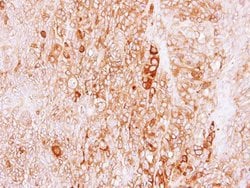 Invitrogen LRGUK Polyclonal Antibody 100 &mu;L; Unconjugated:Antibodies,