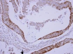Invitrogen SAB Polyclonal Antibody 100 &mu;L; Unconjugated:Antibodies,