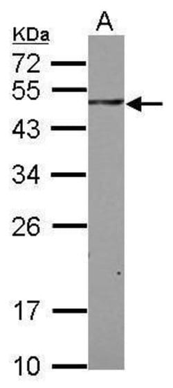 Invitrogen SAB Polyclonal Antibody 100 &mu;L; Unconjugated:Antibodies,