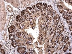 Invitrogen PLK2 Polyclonal Antibody 100 &mu;L; Unconjugated:Antibodies,