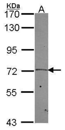 Invitrogen PLK2 Polyclonal Antibody 100 &mu;L; Unconjugated:Antibodies,