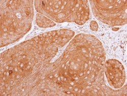 Invitrogen 14-3-3 theta Polyclonal Antibody 100 &mu;L; Unconjugated:Antibodies,