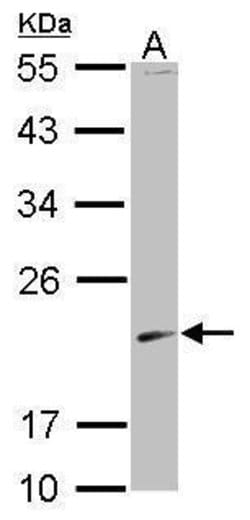 Invitrogen SKP1 Polyclonal Antibody 100 &mu;L; Unconjugated:Antibodies,