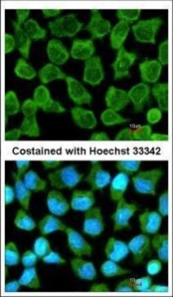 Invitrogen KappaB ras2 Polyclonal Antibody 100 μL; Unconjugated:Antibodies,