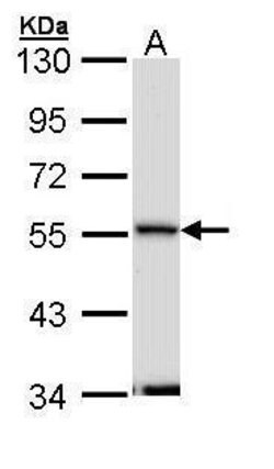 Invitrogen Septin-11 Polyclonal Antibody 100 &mu;L; Unconjugated:Antibodies,