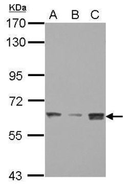 Invitrogen BAF60C Polyclonal Antibody 100 &mu;L; Unconjugated:Anticorps,