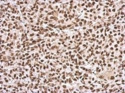 Invitrogen SFPQ Polyclonal Antibody 100 &mu;L | Buy Online | Invitrogen&trade; | Fisher Scientific