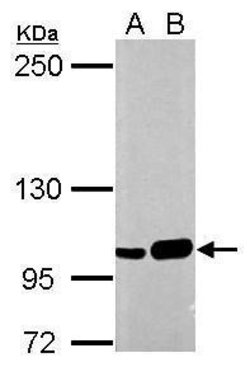 Invitrogen SFPQ Polyclonal Antibody 100 &mu;L | Buy Online | Invitrogen&trade; | Fisher Scientific