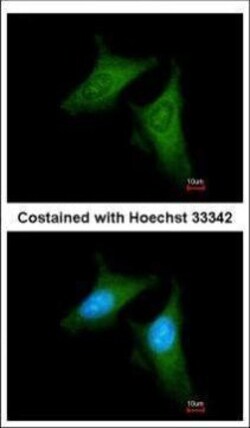 Invitrogen beta COP Polyclonal Antibody 100 &mu;L; Unconjugated:Antibodies,