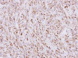 Invitrogen beta COP Polyclonal Antibody 100 &mu;L; Unconjugated:Antibodies,