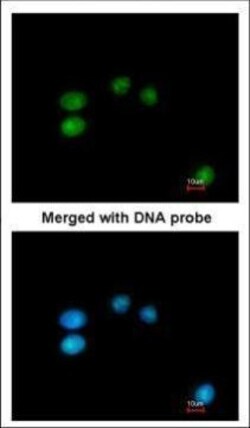 Invitrogen LONRF3 Polyclonal Antibody 100 μL; Unconjugated:Antibodies,