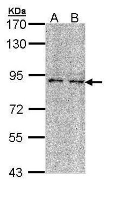 Invitrogen LONRF3 Polyclonal Antibody 100 μL; Unconjugated:Antibodies,