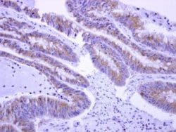 Invitrogen EPS8L2 Polyclonal Antibody 100 &mu;L; Unconjugated:Antibodies,