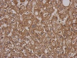 Invitrogen SH2D3C Polyclonal Antibody 100 &mu;L; Unconjugated:Antibodies,