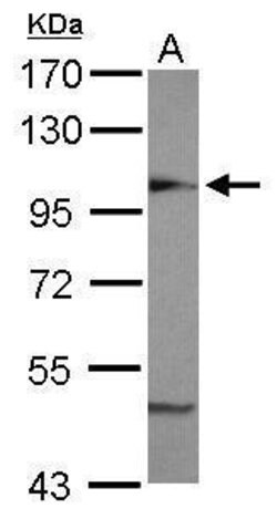 Invitrogen beta COP Polyclonal Antibody 100 &mu;L | Buy Online | Invitrogen&trade; | Fisher Scientific