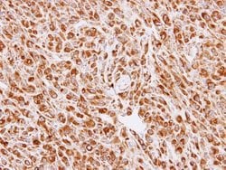 Invitrogen Calreticulin 3 Polyclonal Antibody 100 &mu;L; Unconjugated:Antibodies,