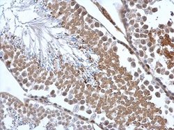 Invitrogen Calreticulin 3 Polyclonal Antibody 100 &mu;L; Unconjugated:Antibodies,