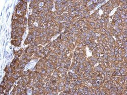 Invitrogen G3BP1 Polyclonal Antibody 100 &mu;L; Unconjugated:Antibodies,