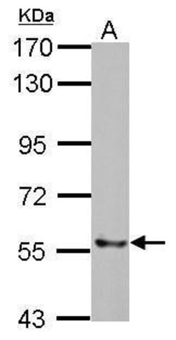 Invitrogen TrxR2 Polyclonal Antibody 100 &mu;L | Buy Online | Invitrogen&trade; | Fisher Scientific