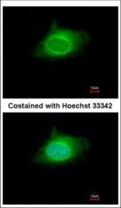 Invitrogen KPNA5 Polyclonal Antibody 100 &mu;L | Buy Online | Invitrogen&trade; | Fisher Scientific