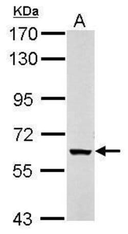 Invitrogen KPNA5 Polyclonal Antibody 100 &mu;L | Buy Online | Invitrogen&trade; | Fisher Scientific