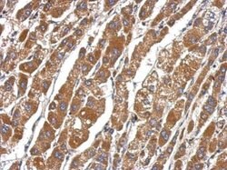 Invitrogen DEAF1 Polyclonal Antibody 100 &mu;L | Buy Online | Invitrogen&trade; | Fisher Scientific