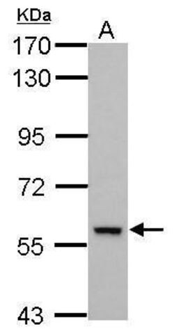Invitrogen DEAF1 Polyclonal Antibody 100 &mu;L | Buy Online | Invitrogen&trade; | Fisher Scientific