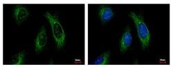 Invitrogen Cytokeratin 4 Polyclonal Antibody 100 &mu;L; Unconjugated:Antibodies,