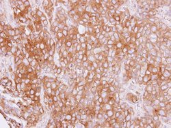 Invitrogen Cytokeratin 4 Polyclonal Antibody 100 &mu;L; Unconjugated:Antibodies,