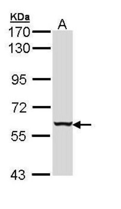 Invitrogen Cytokeratin 4 Polyclonal Antibody 100 &mu;L; Unconjugated:Antibodies,