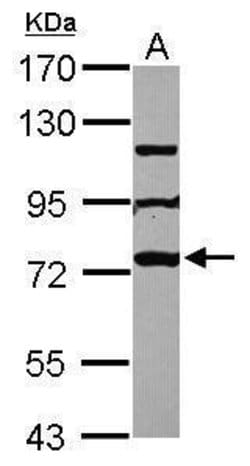 Invitrogen MPP10 Polyclonal Antibody 100 &mu;L; Unconjugated:Antibodies,