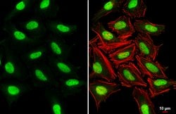 Invitrogen SUV39H1 Polyclonal Antibody 100 &mu;L; Unconjugated:Antibodies,