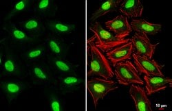 SUV39H1 Polyclonal Antibody, Invitrogen&trade; 100 &mu;L; Unconjugated 